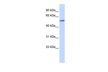 MEIS2 Rabbit Polyclonal Antibody