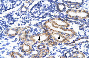MEIS2 Rabbit Polyclonal Antibody