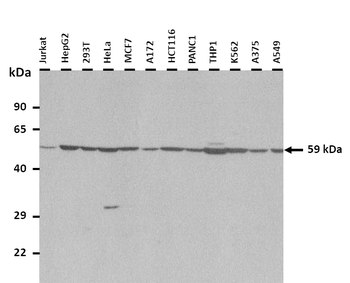 RORA Rabbit Polyclonal Antibody
