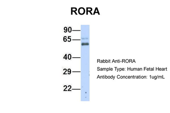 RORA Rabbit Polyclonal Antibody