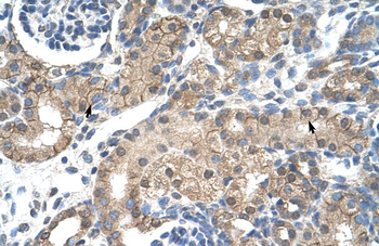 CHRNB2 Rabbit Polyclonal Antibody