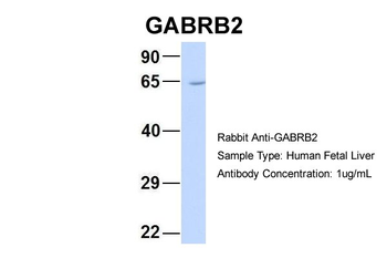GABRB2 Rabbit Polyclonal Antibody
