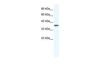 KCNK3 Rabbit Polyclonal Antibody