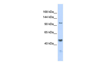 KCNMA1 Rabbit Polyclonal Antibody