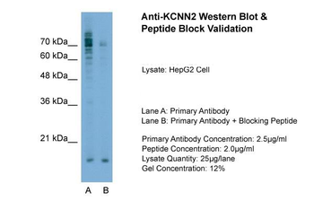 KCNN2 Rabbit Polyclonal Antibody