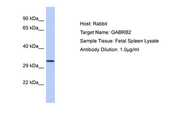 GABRB2 Rabbit Polyclonal Antibody