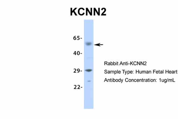 KCNN2 Rabbit Polyclonal Antibody