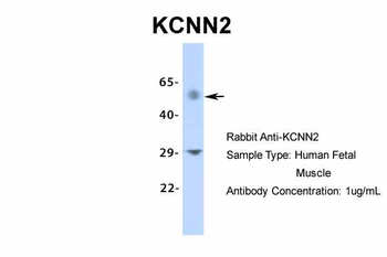 KCNN2 Rabbit Polyclonal Antibody
