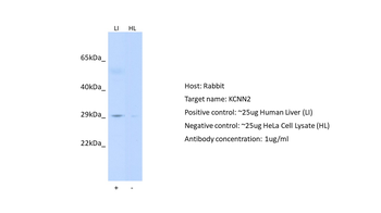 KCNN2 Rabbit Polyclonal Antibody
