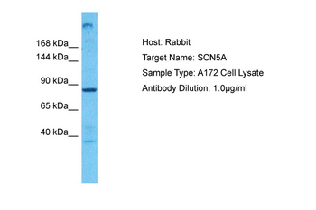 SCN5A Rabbit Polyclonal Antibody