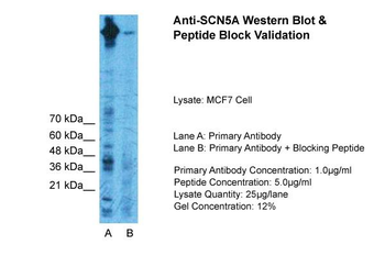 SCN5A Rabbit Polyclonal Antibody
