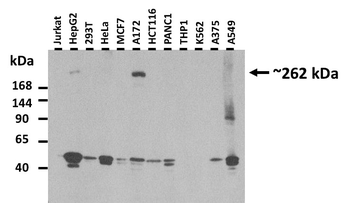 CACNA1G Rabbit Polyclonal Antibody