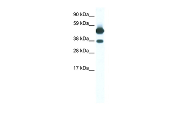 THRB Rabbit Polyclonal Antibody