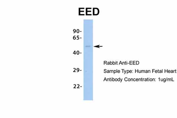 EED Rabbit Polyclonal Antibody