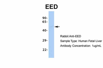 EED Rabbit Polyclonal Antibody