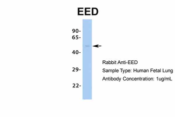 EED Rabbit Polyclonal Antibody