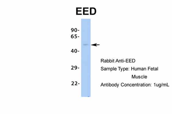 EED Rabbit Polyclonal Antibody
