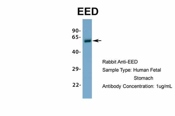 EED Rabbit Polyclonal Antibody