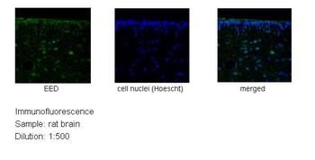 EED Rabbit Polyclonal Antibody