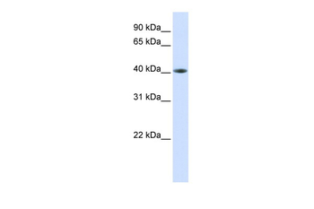 TARDBP Rabbit Polyclonal Antibody