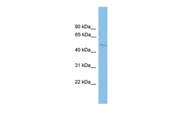 DDX6 Rabbit Polyclonal Antibody