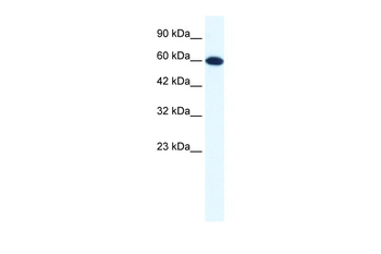 DDX6 Rabbit Polyclonal Antibody