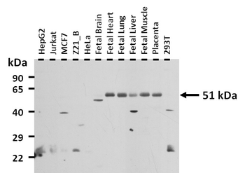 ADRB1 Rabbit Polyclonal Antibody