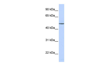 ADRB1 Rabbit Polyclonal Antibody