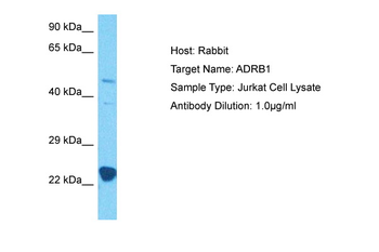 ADRB1 Rabbit Polyclonal Antibody
