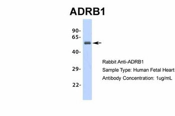 ADRB1 Rabbit Polyclonal Antibody
