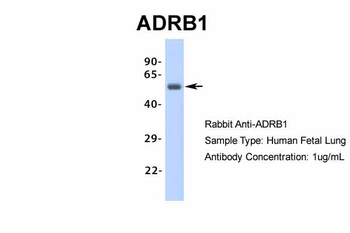 ADRB1 Rabbit Polyclonal Antibody