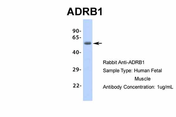 ADRB1 Rabbit Polyclonal Antibody