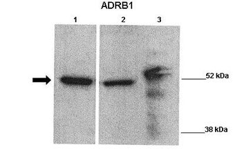 ADRB1 Rabbit Polyclonal Antibody