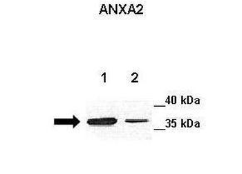 ANXA2 Rabbit Polyclonal Antibody