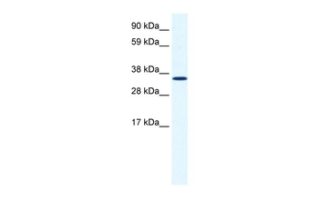 ANXA2 Rabbit Polyclonal Antibody