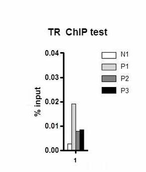 Thrb Rabbit Polyclonal Antibody