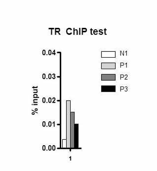 Thrb Rabbit Polyclonal Antibody