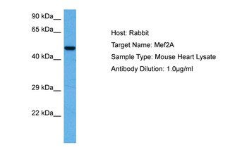 MEF2A Rabbit Polyclonal Antibody