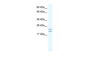 Tppp Rabbit Polyclonal Antibody