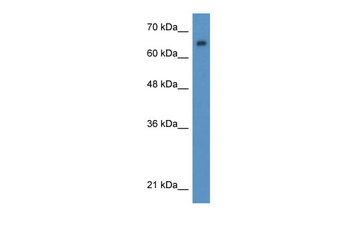 WT1 Rabbit Polyclonal Antibody
