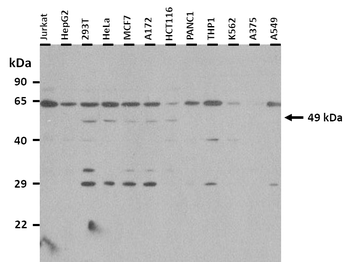 WT1 Rabbit Polyclonal Antibody