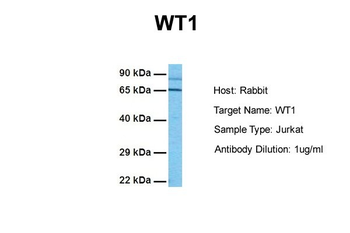 WT1 Rabbit Polyclonal Antibody