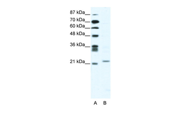 TWIST1 Rabbit Polyclonal Antibody