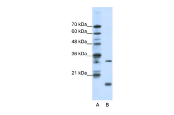MAX Rabbit Polyclonal Antibody