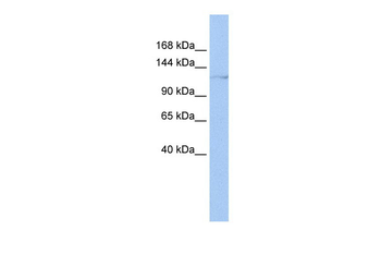 HLTF Rabbit Polyclonal Antibody