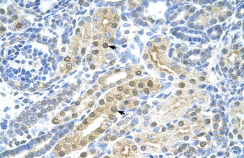TFAP2C Rabbit Polyclonal Antibody