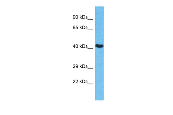 EED Rabbit Polyclonal Antibody