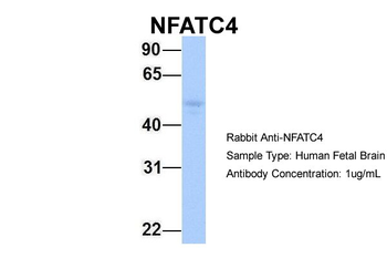 NFATC4 Rabbit Polyclonal Antibody