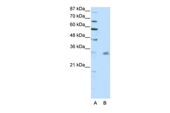 PITX3 Rabbit Polyclonal Antibody