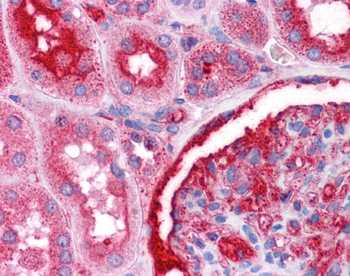 NR4A2 Rabbit Polyclonal Antibody